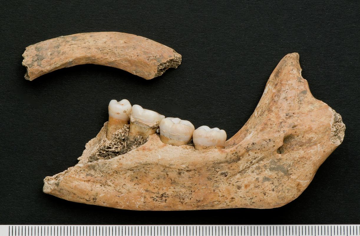 Right upper second molar - human and rib