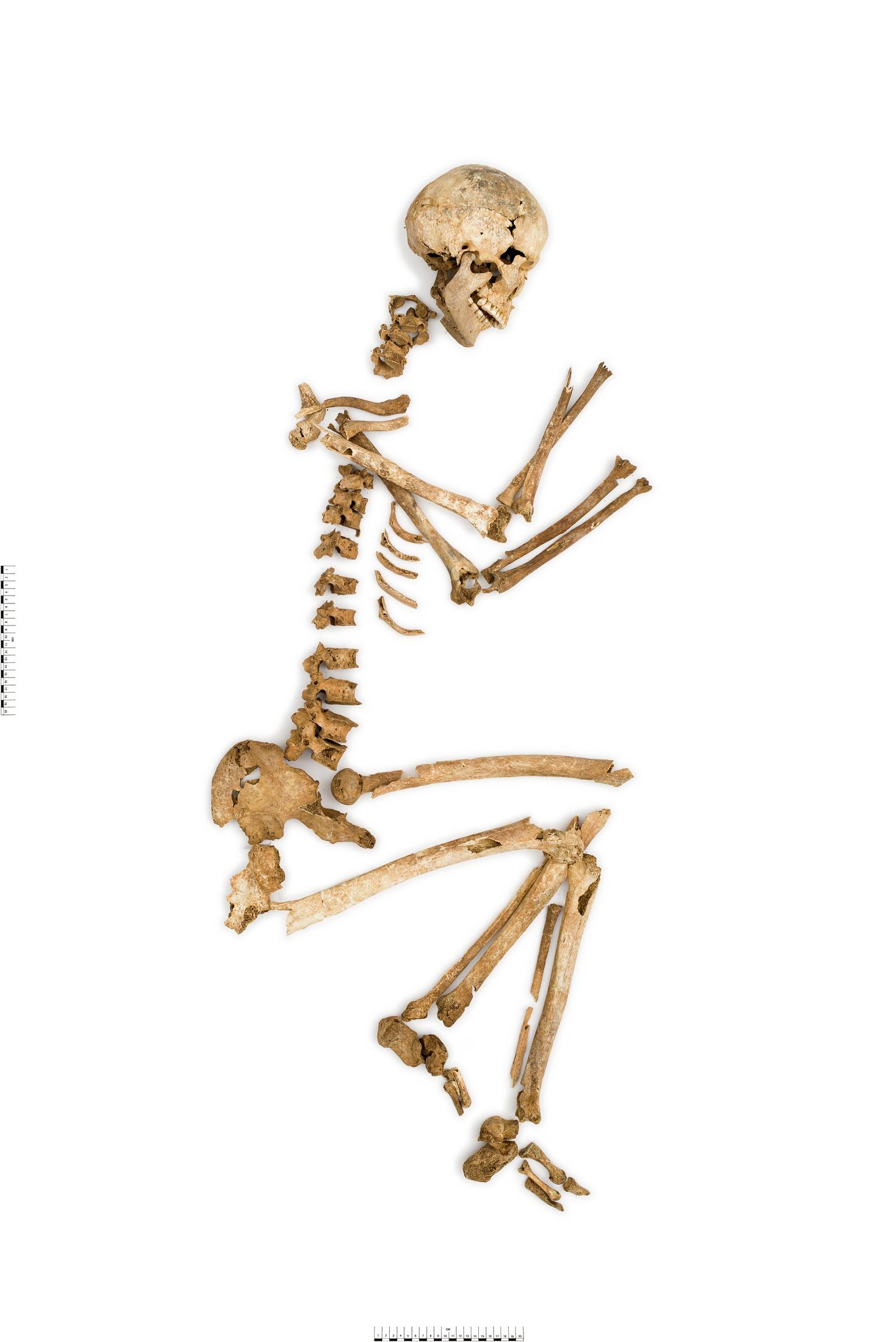 Early Bronze Age human remains