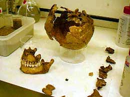 Skull from one of the burials in process of being reconstructed