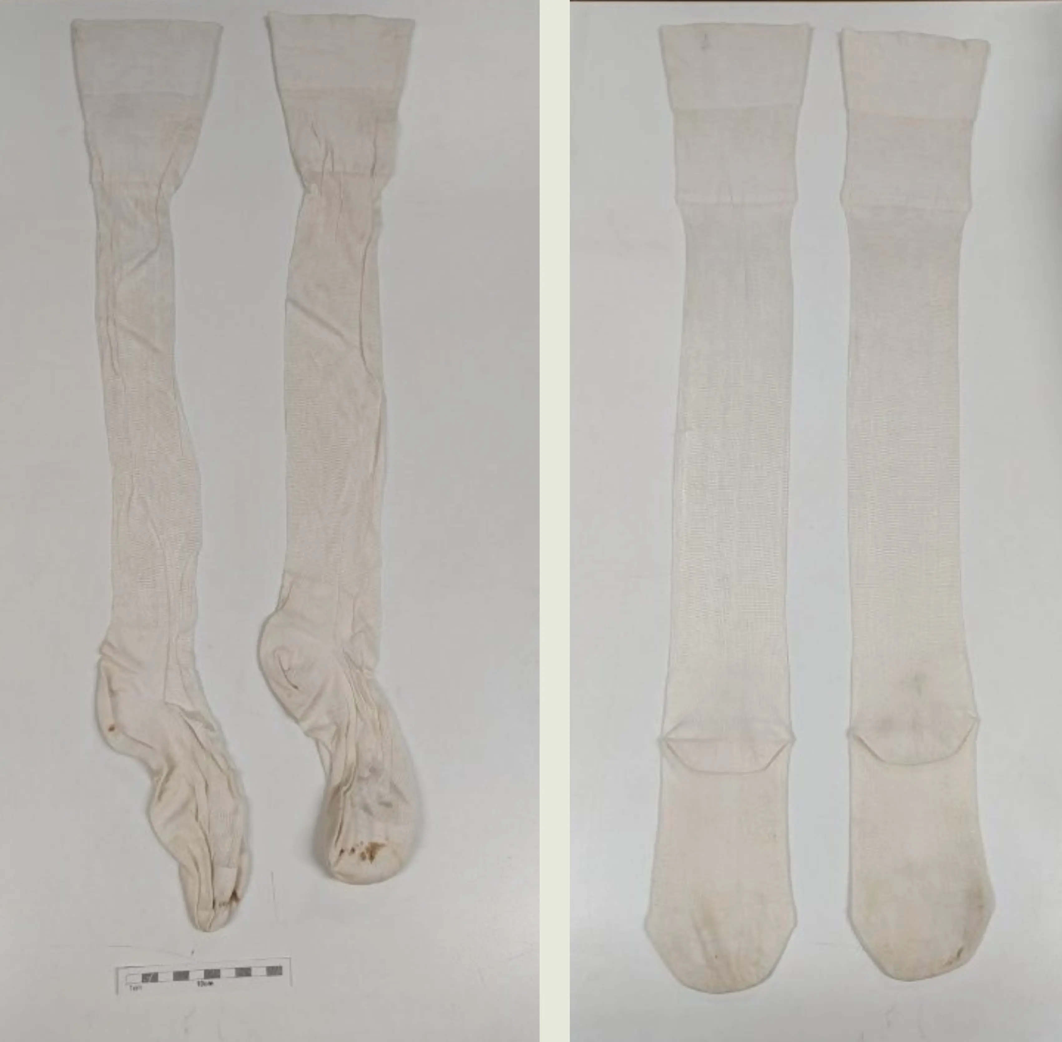 White stockings before and after conservation work 